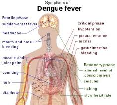 dengue fever images symptoms